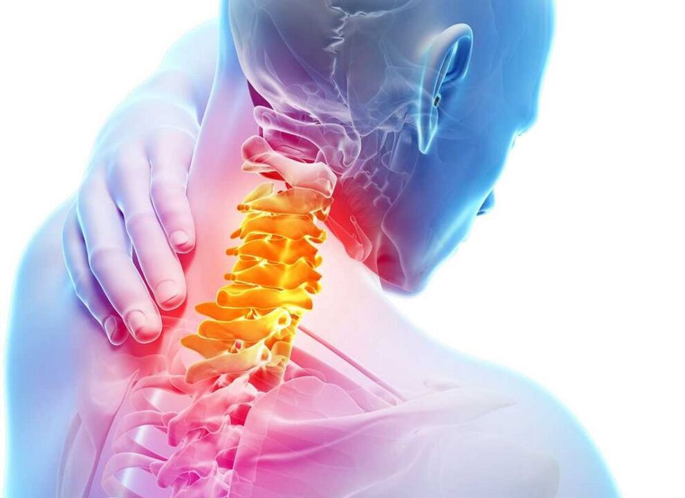 Osteochondrosis: okai, tünetei és kezelése